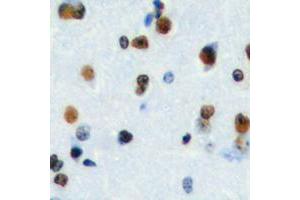 Immunohistochemical analysis of HEN1/2 staining in human brain formalin fixed paraffin embedded tissue section. (HEN1/2 (Center) anticorps)
