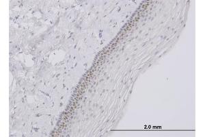 Immunoperoxidase of monoclonal antibody to TFAP4 on formalin-fixed paraffin-embedded human uterine cervix. (TFAP4 anticorps  (AA 93-192))