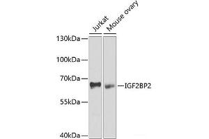 Western blot analysis of extracts of various cell lines using IGF2BP2 Polyclonal Antibody at dilution of 1:1000. (IGF2BP2 anticorps)