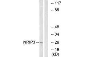 Western blot analysis of extracts from COLO cells, using NRIP3 Antibody. (NRIP3 anticorps  (AA 192-241))