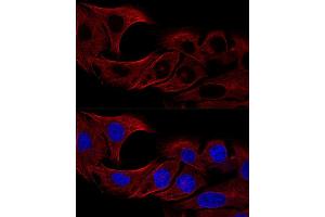 anti-Tubulin, alpha 4a (TUBA4A) (AA 1-180) antibody