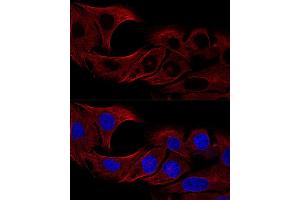 Confocal immunofluorescence analysis of U2OS cells using α-Tubulin antibody (ABIN3020549, ABIN3020550 and ABIN3020551) at dilution of 1:100 (60x lens). (TUBA4A anticorps  (AA 1-180))