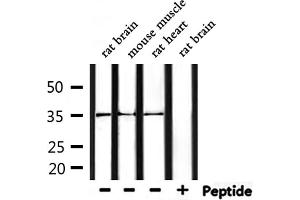 Western blot analysis of extracts from mouse muscle and rat brain and rat heart, using OR52R1 Antibody.