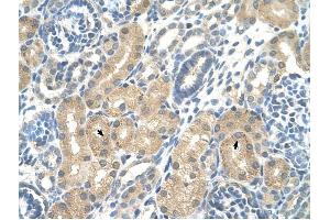 KHK antibody was used for immunohistochemistry at a concentration of 4-8 ug/ml to stain Epithelial cells of renal tubule (arrows) in Human Kidney. (Ketohexokinase anticorps)