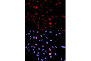 Immunofluorescence (IF) image for anti-Structural Maintenance of Chromosomes 1A (SMC1A) (pSer957) antibody (ABIN3019554) (SMC1A anticorps  (pSer957))