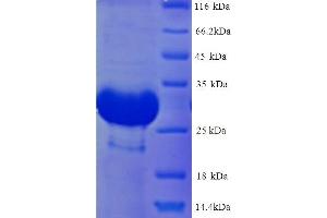 Deiodinase, Iodothyronine, Type III (DIO3) (AA 37-278) protein (His tag)