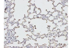 Immunohistochemistry (IHC) image for anti-Eukaryotic Translation Initiation Factor 4A2 (EIF4A2) antibody (ABIN1876482) (EIF4A2 anticorps)