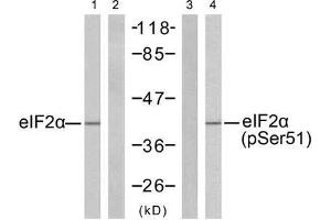 Western blot analysis of extracts from K562 cells untreated or treated with IFN-α (100ng/ml, 20min), using eIF2α (Ab-51) antibody (E021271, Lane 1 and 2) and eIF2α (phospho-Ser51) antibody (E011279, Lane 3 and 4). (EIF2A anticorps  (pSer51))