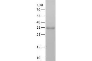 Western Blotting (WB) image for S100 Calcium Binding Protein A3 (S100A3) (AA 1-101) protein (His-IF2DI Tag) (ABIN7124955)