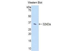Western Blotting (WB) image for anti-Janus Kinase 2 (JAK2) (AA 120-367) antibody (ABIN1176454) (JAK2 anticorps  (AA 120-367))