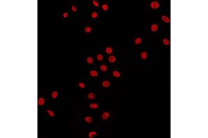 ABIN6269035 staining HT29 by IF/ICC.