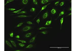 Immunofluorescence of purified MaxPab antibody to RPN2 on HeLa cell.
