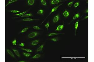Immunofluorescence of purified MaxPab antibody to RPN2 on HeLa cell. (Ribophorin II anticorps  (AA 1-631))
