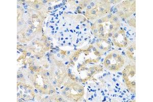 Immunohistochemistry of paraffin-embedded Rat kidney using COTL1 Polyclonal Antibody at dilution of 1:100 (40x lens). (COTL1 anticorps)