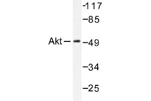 Image no. 1 for anti-V-Akt Murine Thymoma Viral Oncogene Homolog 1 (AKT1) antibody (ABIN265304) (AKT1 anticorps)