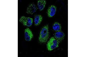 Confocal immunofluorescent analysis of IL13 Antibody (C-term) (ABIN657659 and ABIN2846653) with NCI- cell line followed by Alexa Fluor 488-conjugated goat anti-rabbit lgG (green). (IL-13 anticorps  (C-Term))