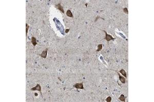 Immunohistochemical staining of human hippocampus shows strong cytoplasmic positivity in neuronal cells. (YARS anticorps)
