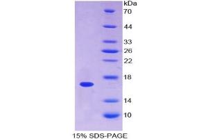 SDS-PAGE of Protein Standard from the Kit  (Highly purified E. (Annexin A3 Kit ELISA)