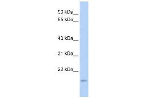 TNFAIP8L1 antibody used at 1 ug/ml to detect target protein. (TNFAIP8L1 anticorps  (Middle Region))