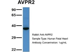 Host: Rabbit  Target Name: AVPR2  Sample Tissue: Human Fetal Heart  Antibody Dilution: 1. (AVPR2 anticorps  (C-Term))