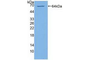 Western blot analysis of recombinant Human PI4Ka. (PI4KA anticorps  (AA 1-300))
