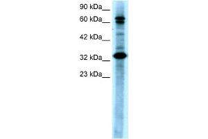 WB Suggested Anti-MAP3K7IP2 Antibody Titration:  0. (TAB2 anticorps  (N-Term))