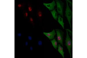 ABIN6266054 and ABIN6276599 staining  cells by IF/ICC.