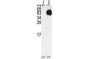 Western blot analysis of PDX1 antibody and 293 cell lysate either nontransfected (Lane 1) or transiently transfected with the PDX1 gene (2). (PDX1 anticorps  (AA 40-69))