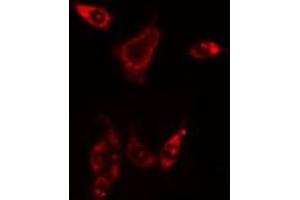 ABIN6275852 staining HuvEc cells by IF/ICC. (PHKG1 anticorps  (Internal Region))