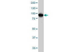 ATP2C1 monoclonal antibody (M01), clone 2G1 Western Blot analysis of ATP2C1 expression in HeLa .