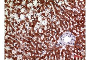 Immunohistochemistry (IHC) analysis of paraffin-embedded Human Liver, antibody was diluted at 1:100. (HSD11B1 anticorps  (Internal Region))