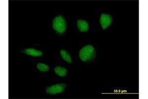 Immunofluorescence of purified MaxPab antibody to ZBTB39 on HeLa cell. (ZBTB39 anticorps  (AA 1-712))