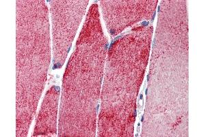 Immunohistochemistry (IHC) image for anti-Actinin, alpha 3 (ACTN3) (N-Term) antibody (ABIN2777061)