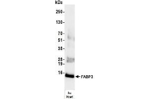 Western Blotting (WB) image for anti-Fatty Acid Binding Protein 3, Muscle and Heart (FABP3) antibody (ABIN7795612) (FABP3 anticorps)