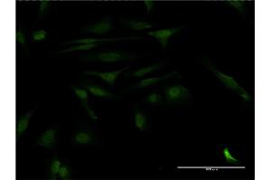 Immunofluorescence of monoclonal antibody to CALCOCO2 on HeLa cell. (CALCOCO2 anticorps  (AA 347-446))