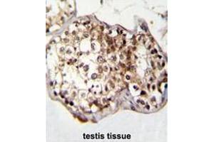 CAF-1 Antibody (N-term) immunohistochemistry analysis in formalin fixed and paraffin embedded human testis tissue followed by peroxidase conjugation of the secondary antibody and DAB staining. (CNOT7 anticorps  (N-Term))