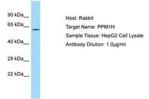 Image no. 1 for anti-Protein Phosphatase 1H (PP2C Domain Containing) (PPM1H) (AA 71-120) antibody (ABIN6750020) (PPM1H anticorps  (AA 71-120))