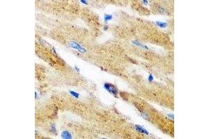 Immunohistochemical analysis of Kynureninase staining in mouse heart formalin fixed paraffin embedded tissue section. (KYNU anticorps)