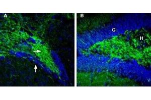 Expression of Synapsin-2 in mouse ventral striatum and rat hippocampus - Immunohistochemical staining of perfusion-fixed frozen mouse brain sections with Anti-Synapsin II (SYN2) Antibody (ABIN7043787, ABIN7044660 and ABIN7044661), (1:200), followed by goat-anti-rabbit-AlexaFluor-488 (green staining).