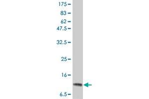 Western Blot detection against Immunogen (15.