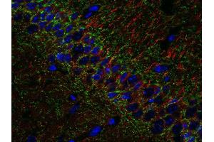 Indirect immunostaining of PFA fixed, paraffin embedded mouse hippocampus section with anti-β3 tubulin (dilution 1 : 500; red)and mouse anti-CB1 R (cat.