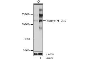 Western blot analysis of extracts of C6 cells, using Phospho-RB-S780 Rabbit mAb (ABIN7269936) at 1:1000 dilution. (Retinoblastoma 1 anticorps  (pSer780))