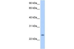 Western Blotting (WB) image for anti-PQ Loop Repeat Containing 1 (PQLC1) antibody (ABIN2463302) (PQLC1 anticorps)
