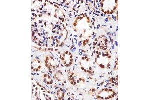 Immunohistochemical analysis of paraffin-embedded H. (PPARA anticorps  (AA 1-468))