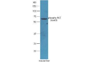 Mouse liver lysates probed with Rabbit Anti-AKT(Ser473) Polyclonal Antibody, Unconjugated  at 1: 5000 for 90min at 37˚C. (AKT 1/2/3 anticorps  (pSer473))