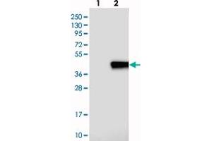 Western blot analysis of Lane 1: Negative control (vector only transfected HEK293T lysate), Lane 2: Over-expression Lysate (Co-expressed with a C-terminal myc-DDK tag (~3. (PLEKHF1 anticorps)