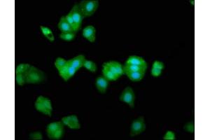 Immunofluorescence staining of HepG2 cells with ABIN7172879 at 1:266, counter-stained with DAPI. (TRPV2 anticorps  (AA 1-117))