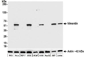 Western Blotting (WB) image for anti-Vimentin (VIM) (AA 325-375) antibody (ABIN7449539)