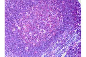 Anti-RAPGEF6 / RAGEF2 antibody IHC of human tonsil, germinal center.