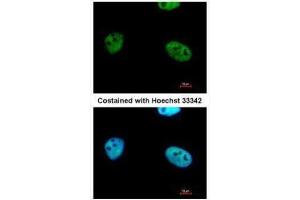ICC/IF Image Immunofluorescence analysis of paraformaldehyde-fixed HeLa, using WTAP, antibody at 1:500 dilution. (WTAP anticorps  (Center))